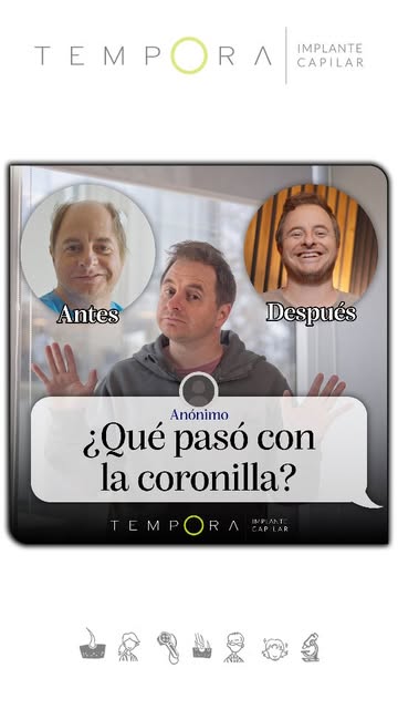 A veces una foto no cuenta toda la historia. 👀

En mi caso, como la zona con calvicie era tan ampli
