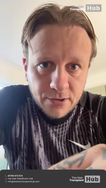 Discover his honest insights and real experience throughout his hair transplant journey with The Hai