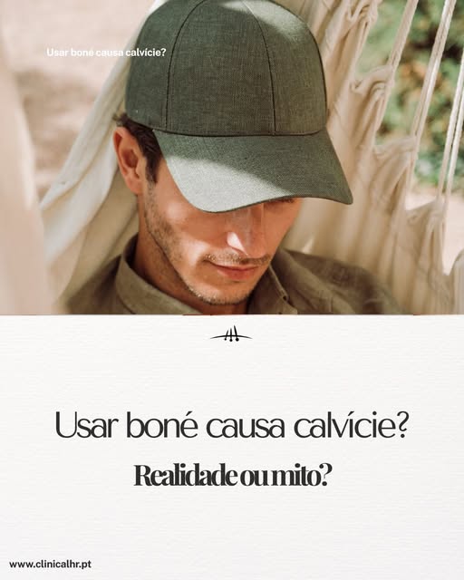 Usar boné causa calvície? Realidade ou mito?

A resposta é simples: Mito.

É comum ouvir que usar bo