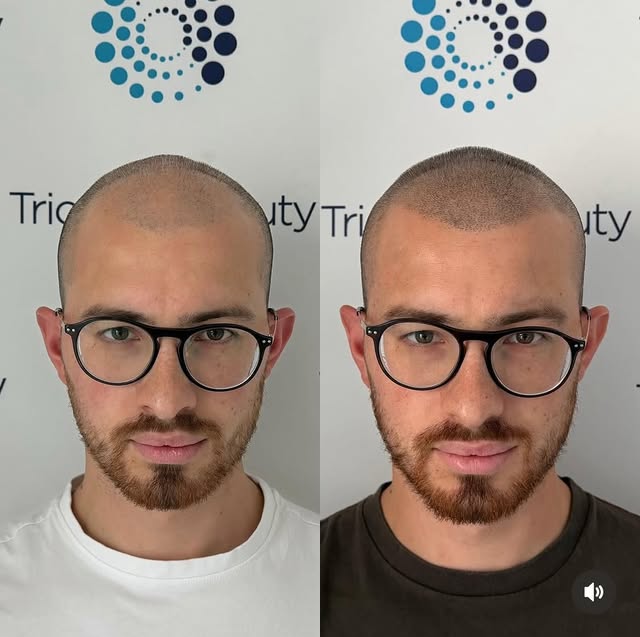 …è solo un trattamento estetico @emanuele_lucarelli_