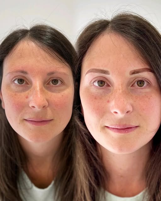 Isn’t it amazing what #brows can do? Love a new makeover…. Will heal soft as #naturalbrows #coloress