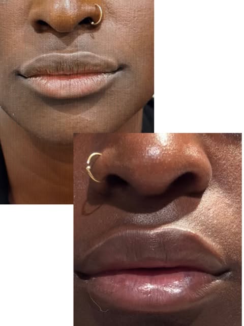 She wanted a fuller, plumper lip, more hydration but not too “ducky”  Mission accomplished 👄💋#inve