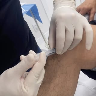 🦵 Você sabia que o seu próprio sangue pode ser utilizado para estimular os mecanismos naturais de r