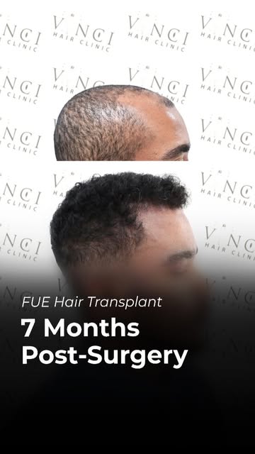 Can you imagine the impact of a change like this on your self-esteem?

Daniel lived with changes to 