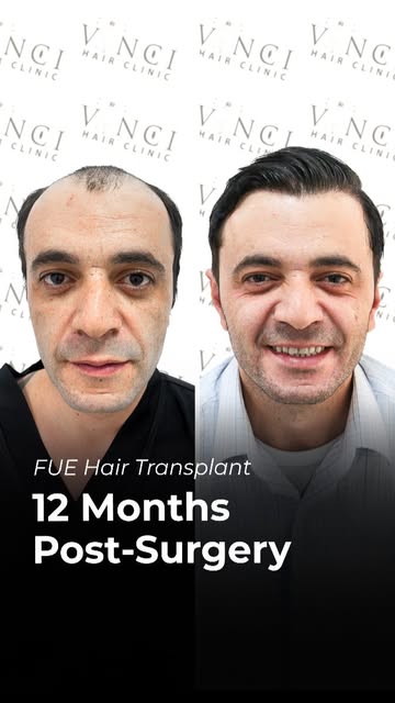 Some transformations make you do a double-take just to check it's the same person.

Cristiano’s case