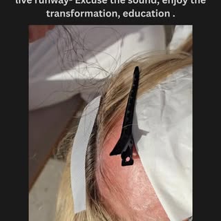 Most people think hair restoration is about covering hair.
What I do is build up the volume 400%-600