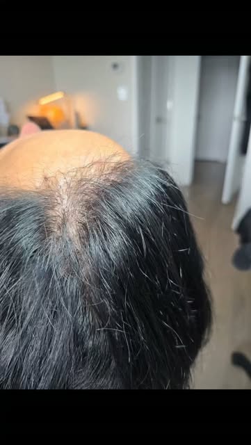 👇 Tell me in the comments: YES or NO?

4HairPlus — small addition, BIG difference.

201-245-2548 
4
