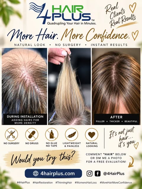 ✨ We forgot the BEFORE photo… but the transformation was too good not to share! ✨
❤️

 Just carefull