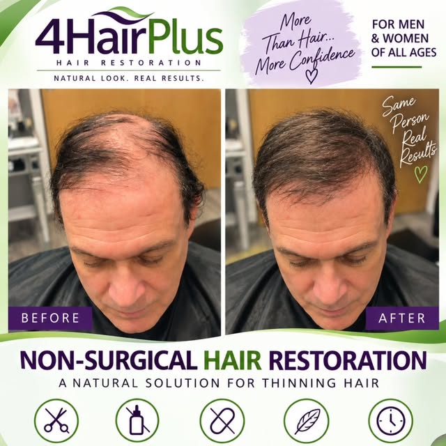 One natural hair at a time.
 ❤️
At 4HairPlus, we add 4–6 lightweight hairs to one existing natural h