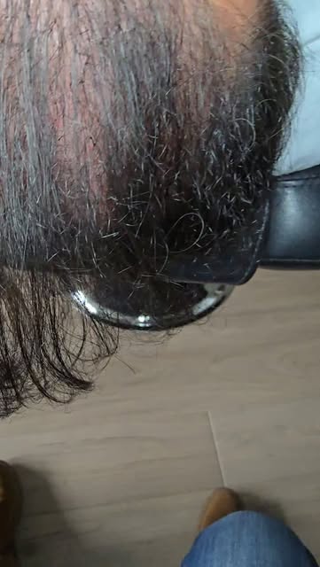 Look closely 👀 These tiny attachment points are at different distances from the scalp.
Why? Because