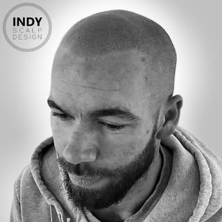 Game changing new hairline for our client here… reach out when you’re ready for yours!

Indiana’s SM