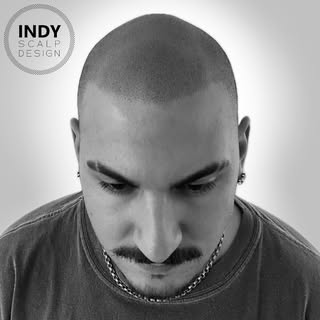 It’s a great time to be a bald guy in Indiana right about now… YOU get a new hairline and YOU get a 