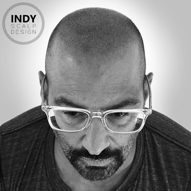 Soft, natural, completely undetectable.  Reach out for your free consultation today!

Indiana’s SMP 