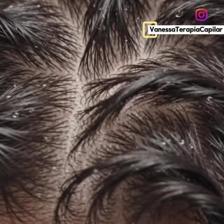 Você sabe como funciona o sistema do couro cabeludo? 🧬 Neste vídeo, mostramos as estruturas respons