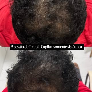 5 sessões de Terapia Capilar. E não foi apenas sobre o cabelo. ✨

Esse resultado mostra o que aconte