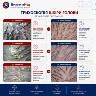 Догляд за шкірою голови — основа
здорового волосся
...
Багато проблем із волоссям починаються саме з