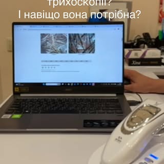 Що ми бачимо під час трихоскопії?

І навіщо вона потрібна саме Вам?

Волосся може випадати місяцями,
