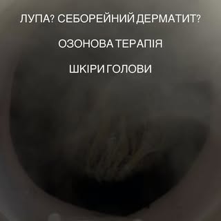Себорейний дерматит?
Лупа, свербіж, жирність шкіри голови постійно повертаються?

Озонова терапія шк