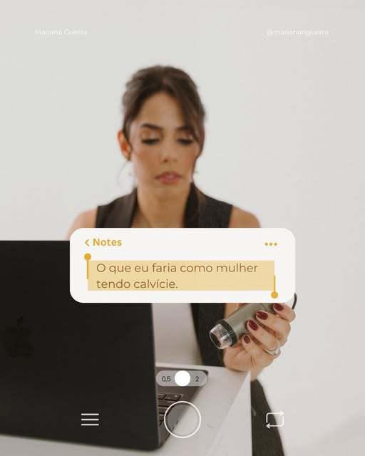 Se eu estivesse percebendo sinais de calvície, não esperaria a situação avançar para começar a cuida