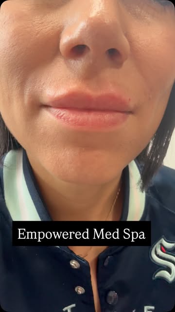 A little lip flip 💋 + a little B12 boost ⚡️ because apparently my lips AND my energy needed some at