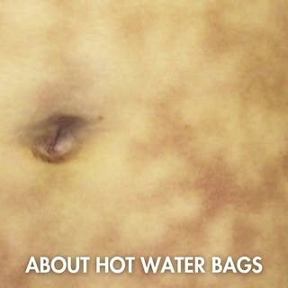Hot water bags may seem harmless, but prolonged heat exposure can permanently damage your skin. If y
