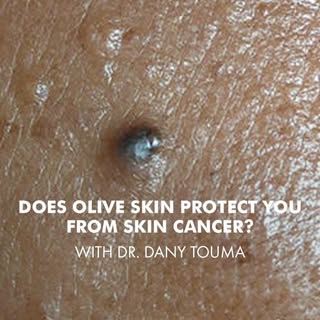 Olive skin has more natural protection—but it is not immune to sun damage or skin cancer. Wear sunsc