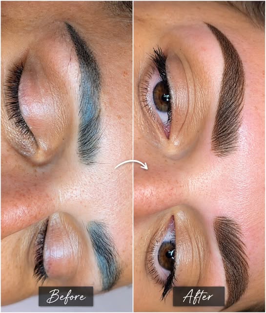 💙➡️🤎 From BLUE to BEAUTIFUL.

This client's old brows had turned blue-gray over the years — one of