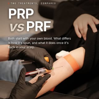 PRP and PRF both start with your own blood, so the question is not which is better, it is which suit