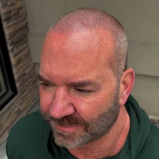 Zoom in on the after photo 👀

From thinning to fuller-looking hair.

Scalp Micropigmentation is des