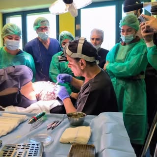 Some movements from today’s #livesurgeryworkshop @societaitalianaditricologia @ishrs @devroyeinstrum