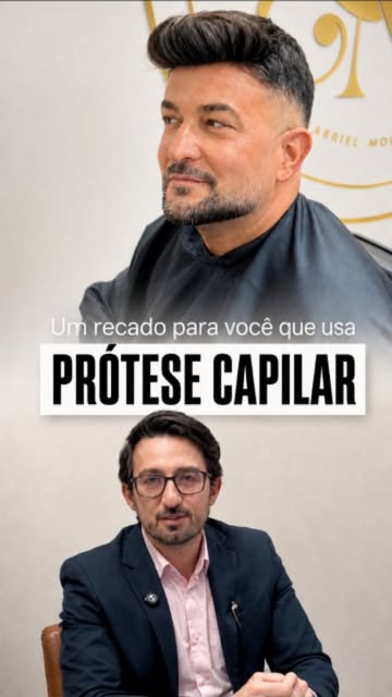 Eu entendo por que a prótese capilar chama tanta atenção: você coloca hoje e, aparentemente, o probl