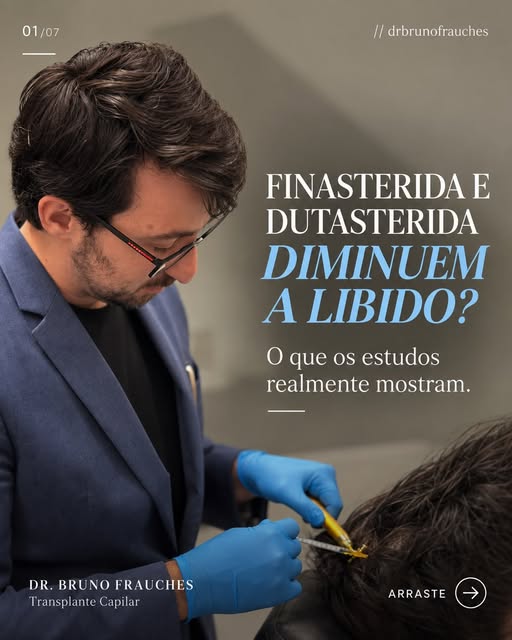 Finasterida e dutasterida “acabam com a libido”? O medo costuma ser maior do que o risco real.

Quan