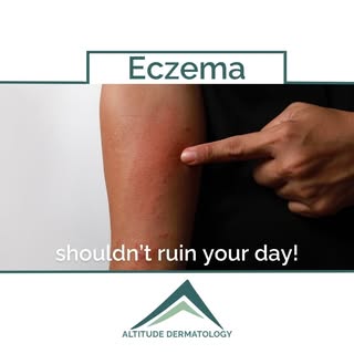 Eczema flare-ups shouldn't ruin your day! At Altitude Dermatology, we provide care to soothe and man