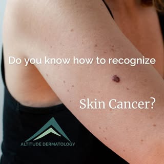Here are some signs to watch for:
🚨 Look out for unusual moles, changes in shape or color, and any 
