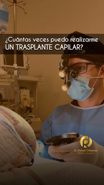 Agenda tu consulta de evaluación 📲 +56 9 7805 0604

#drrafaelodremanchile #fuezafiro #fue #injertoc