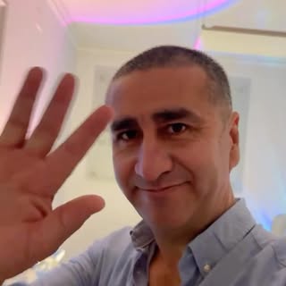 @marcelo_caro.m nos cuenta cómo va su proceso post operatorio luego de su cirugía de implante capila