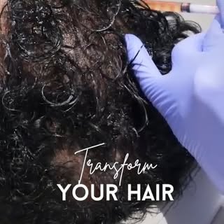 𝐑𝐞𝐯𝐢𝐯𝐞 𝐘𝐨𝐮𝐫 𝐇𝐚𝐢𝐫 𝐰𝐢𝐭𝐡 𝐏𝐑𝐏 𝐓𝐡𝐞𝐫𝐚𝐩𝐲!

Is your hair thinning? PRP Therapy c