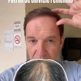 Te hablamos sobre el “patrón de calvicie femenina”.

En este reel, el Dr. Marinacci explica las prin