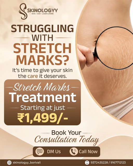 Say goodbye to the worry and hello to smoother, healthier-looking skin. 💫

Our Stretch Marks Treatm