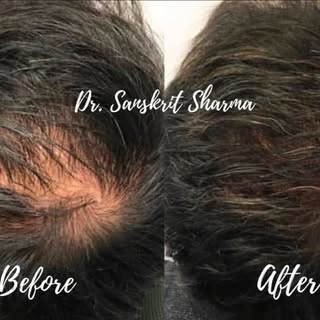 ✨“From Thinning To Thriving-Powered by GFC.”✨

GFC Treatment — because real results never lie.
This 