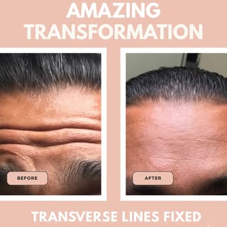 We had to share one of our most-loved before-and-afters again! 😍

This transformation shows what ca