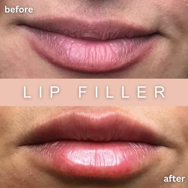 Ready to love your lips like never before?😍 Results like this are only one appointment away!

Every