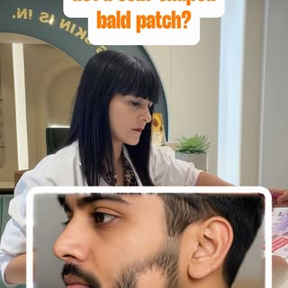 Got a coin-shaped bald patch? 👀

Don’t panic—and don’t start experimenting with DIY remedies. 🧅❌

