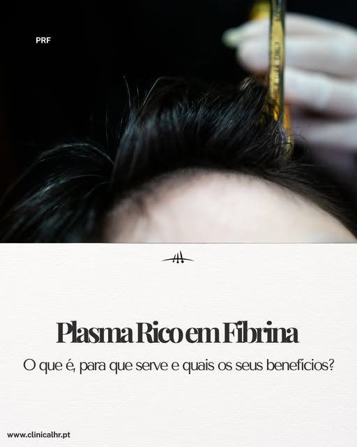 PRF: quando o seu próprio organismo ajuda no processo de regeneração.

Sabia que é possível utilizar