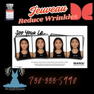 🌟 Ready to say goodbye to wrinkles and hello to youthful, radiant skin? 

Introducing Jeuveau by Ev