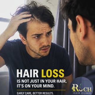 💇‍♂️ **Confidence Looks Better with Healthy Hair.** ✨ Contact No: +919762071616, +918180007157

Hai