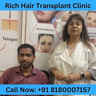 ✅Rich Hair Transplant & Restoration Center is Most Trusted Hair Transplant clinic in Pune .
✅Our Bra