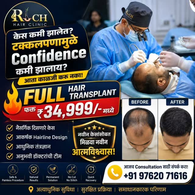 केस कमी झालेत? टक्कलपणामुळे Confidence कमी झालाय?
आता काळजी करू नका!
🔥 FULL HAIR TRANSPLANT फक्त ₹3