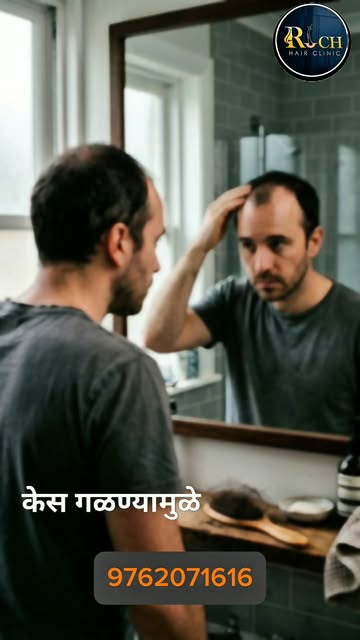✨Confidence Looks Better with Healthy Hair✨ Contact No: +919762071616, +918180007157

Hair loss may 