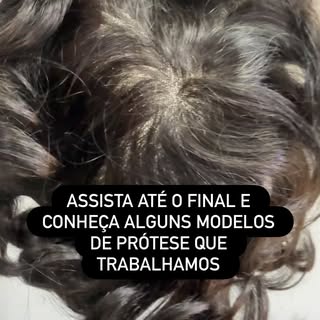 Este vídeo contém alguns modelos de próteses que trabalhamos.